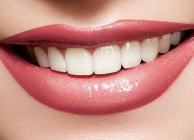سفید کردن دندان ها؛ از روش های درمانی تا راهکار های خانگی